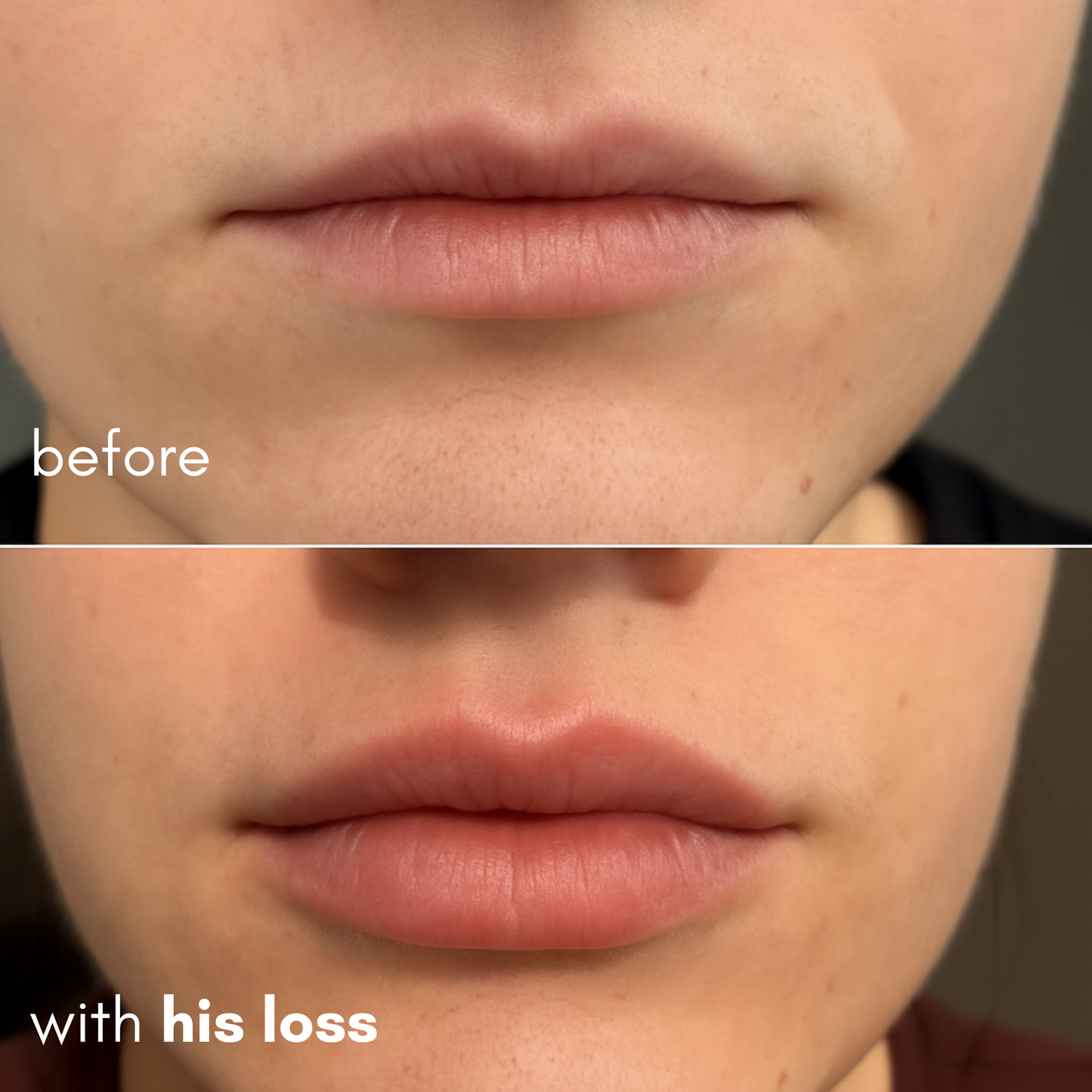 His Loss Extreme Lip Plumper