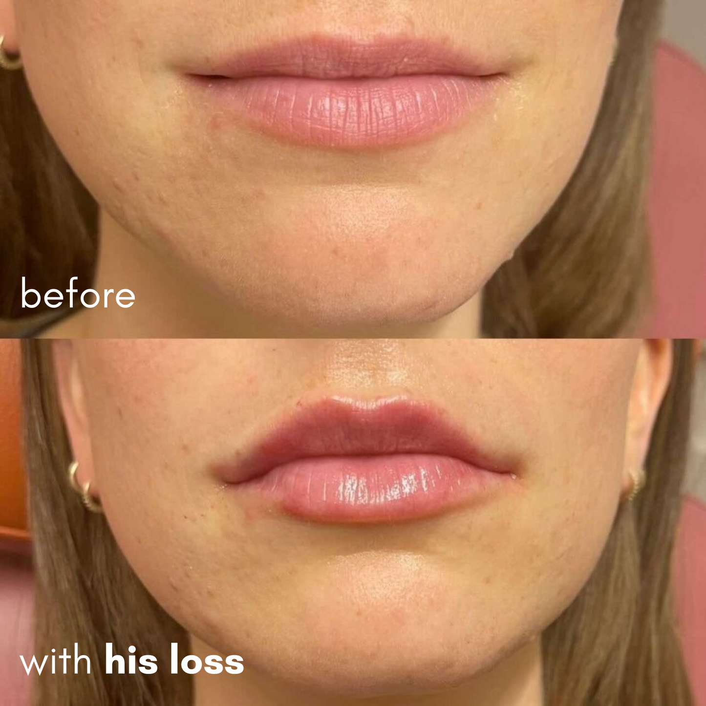 His Loss Extreme Lip Plumper